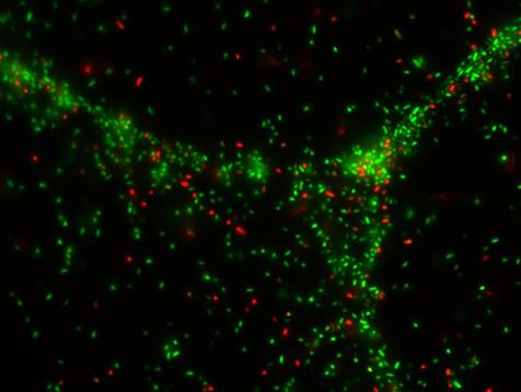 Shigella flexneri viewed with live/dead stain